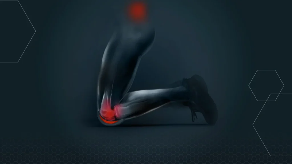 Põlvili töötamine = põlveliigese osteoartriit?