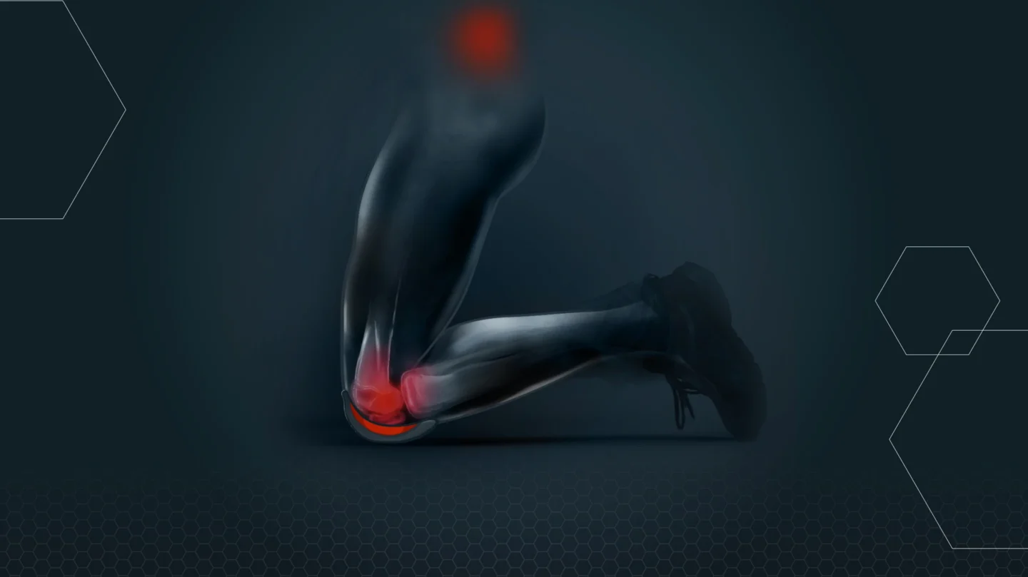 Põlvili töötamine = põlveliigese osteoartriit?